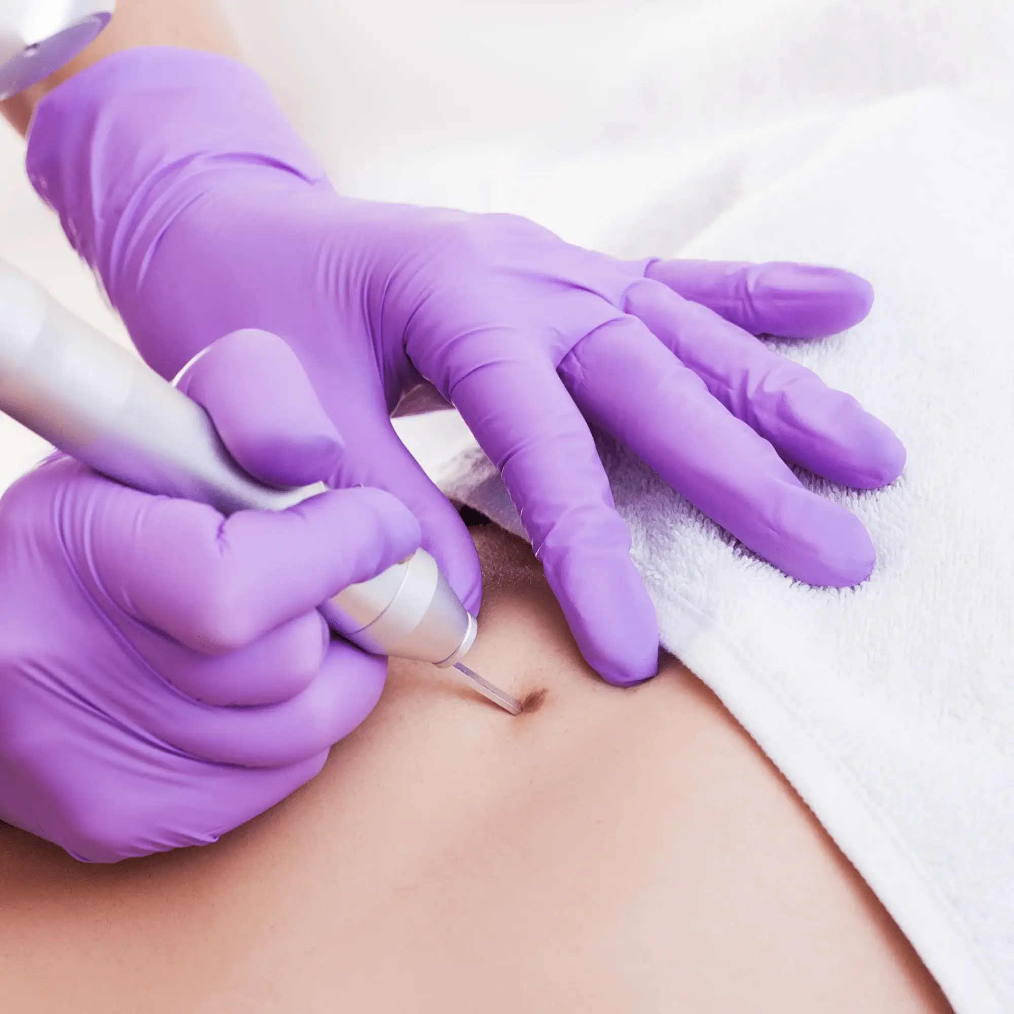 Excizii Formațiuni Tumorale