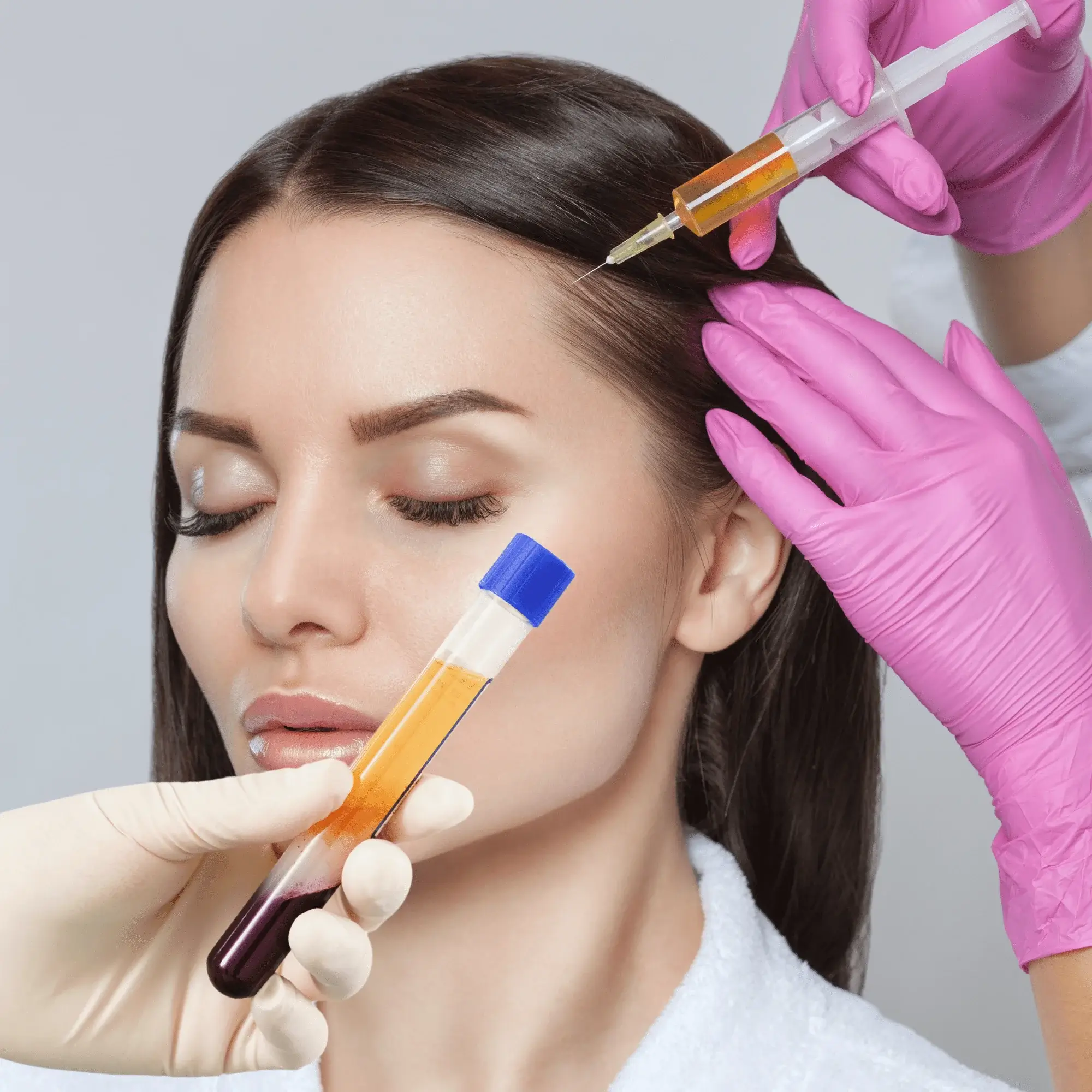 PRP - Terapia Vampir