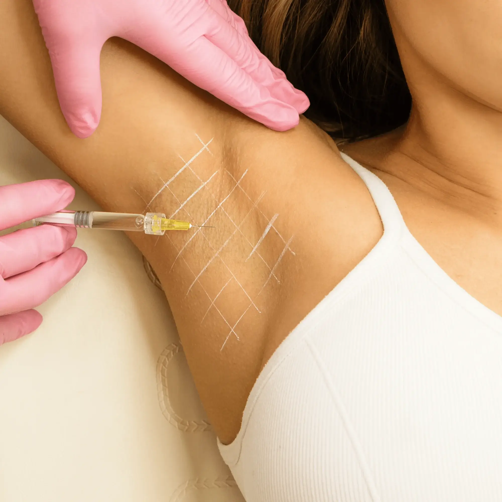 Tratament pentru Hiperhidroză