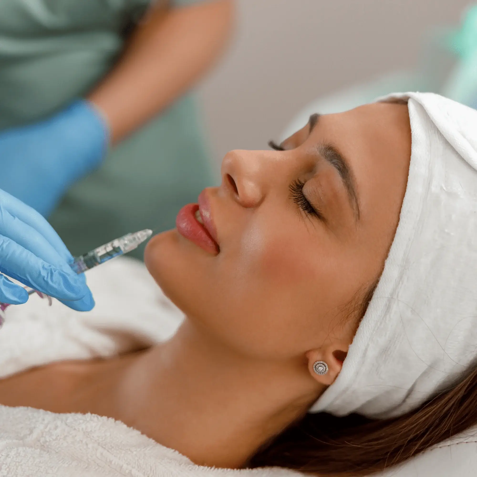 Volumizarea Buzelor cu Acid Hialuronic